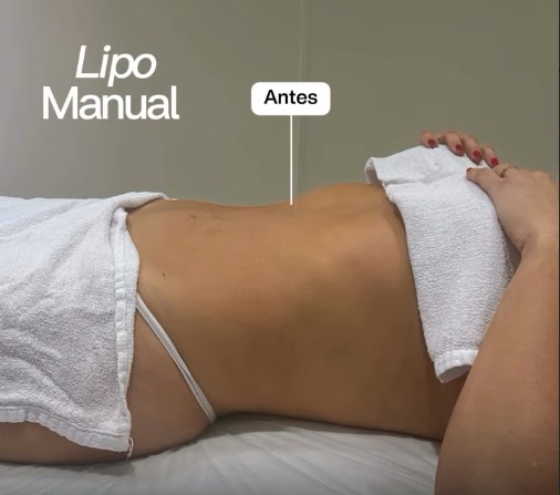 Abdômen antes da sessão de lipo manual